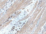 Cytokeratin 7 Antibody in Immunohistochemistry (Paraffin) (IHC (P))