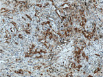 Cytokeratin 7 Antibody in Immunohistochemistry (Paraffin) (IHC (P))