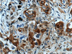 Cytokeratin 7 Antibody in Immunohistochemistry (Paraffin) (IHC (P))