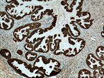 Cytokeratin 7 Antibody in Immunohistochemistry (Paraffin) (IHC (P))
