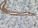 Cytokeratin 7 Antibody in Immunohistochemistry (Paraffin) (IHC (P))