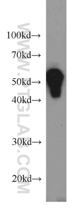 Cytokeratin 7 Antibody in Western Blot (WB)