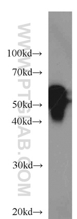Cytokeratin 7 Antibody in Western Blot (WB)