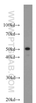 Cytokeratin 7 Antibody in Western Blot (WB)