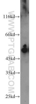 Cytokeratin 7 Antibody in Western Blot (WB)