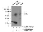 PPARA Antibody in Immunoprecipitation (IP)