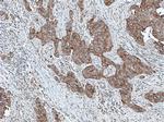 MRPL49 Antibody in Immunohistochemistry (Paraffin) (IHC (P))