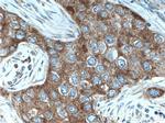 MRPL49 Antibody in Immunohistochemistry (Paraffin) (IHC (P))