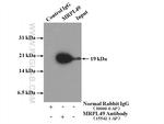 MRPL49 Antibody in Immunoprecipitation (IP)