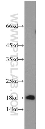 MRPL49 Antibody in Western Blot (WB)