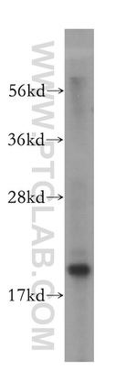 MRPL49 Antibody in Western Blot (WB)