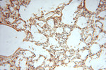MRPL11 Antibody in Immunohistochemistry (Paraffin) (IHC (P))