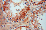 PDIR Antibody in Immunohistochemistry (Paraffin) (IHC (P))