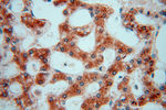 PDIR Antibody in Immunohistochemistry (Paraffin) (IHC (P))