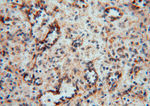 PDIR Antibody in Immunohistochemistry (Paraffin) (IHC (P))