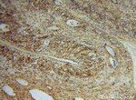 PDIR Antibody in Immunohistochemistry (Paraffin) (IHC (P))