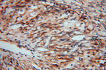 PDIR Antibody in Immunohistochemistry (Paraffin) (IHC (P))