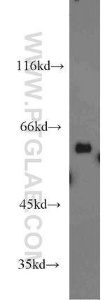 PDIR Antibody in Western Blot (WB)