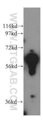 PDIR Antibody in Western Blot (WB)