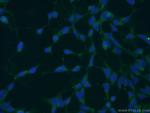 UROD Antibody in Immunocytochemistry (ICC/IF)