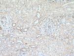 NADK Antibody in Immunohistochemistry (Paraffin) (IHC (P))