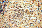 PGAM2 Antibody in Immunohistochemistry (Paraffin) (IHC (P))