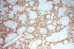 PGAM2 Antibody in Immunohistochemistry (Paraffin) (IHC (P))