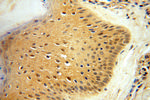 PGAM2 Antibody in Immunohistochemistry (Paraffin) (IHC (P))
