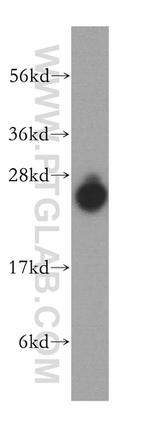 KCTD2/5/17 Antibody in Western Blot (WB)