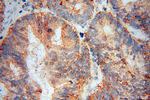 KCTD2/5/17 Antibody in Immunohistochemistry (Paraffin) (IHC (P))