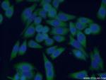 DIRAS2 Antibody in Immunocytochemistry (ICC/IF)