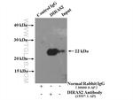 DIRAS2 Antibody in Immunoprecipitation (IP)