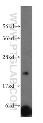 DIRAS2 Antibody in Western Blot (WB)