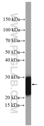 DIRAS2 Antibody in Western Blot (WB)