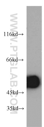 ZNF259 Antibody in Western Blot (WB)