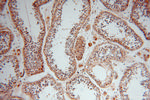 ALDH1B1 Antibody in Immunohistochemistry (Paraffin) (IHC (P))