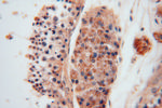ALDH1B1 Antibody in Immunohistochemistry (Paraffin) (IHC (P))