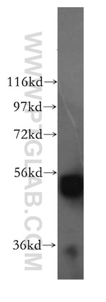 ALDH1B1 Antibody in Western Blot (WB)
