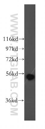 ALDH1B1 Antibody in Western Blot (WB)