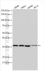RPS2 Antibody in Western Blot (WB)