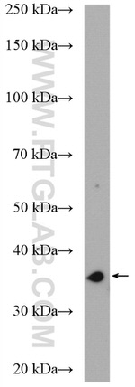 DIMT1L Antibody in Western Blot (WB)