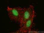 SEH1L Antibody in Immunocytochemistry (ICC/IF)