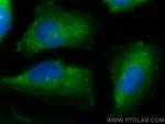AGBL5/CCP5 Antibody in Immunocytochemistry (ICC/IF)