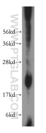 NDUFB9 Antibody in Western Blot (WB)