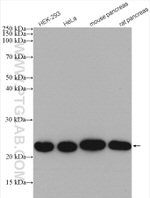 NDUFB9 Antibody in Western Blot (WB)