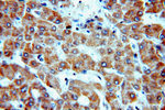 NDUFC2 Antibody in Immunohistochemistry (Paraffin) (IHC (P))