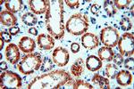 NDUFC2 Antibody in Immunohistochemistry (Paraffin) (IHC (P))
