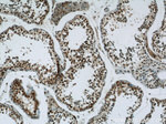 GMCL1 Antibody in Immunohistochemistry (Paraffin) (IHC (P))
