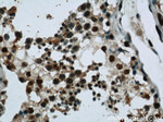 GMCL1 Antibody in Immunohistochemistry (Paraffin) (IHC (P))