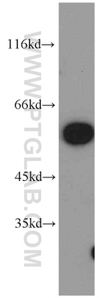 GMCL1 Antibody in Western Blot (WB)
